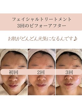 ココロ(COCORO)/お肌とカラダを整えるセルラム