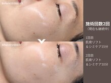 アンドアンド(&and)/ツヤが増してトーンアップ☆