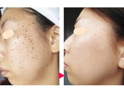 アイビューティーセンターの写真