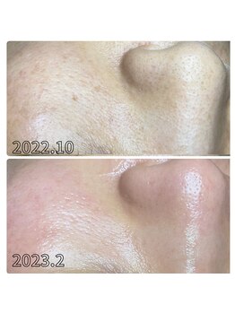 プアラ(puala)/お肌の変化