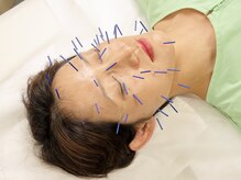 養源堂 上野/美容鍼