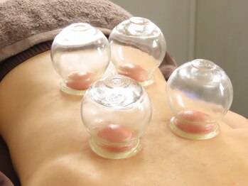 いん鍼灸治療院/＜吸玉施術＞