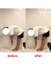 ナオル整体 福岡香椎院(NAORU整体)/30男性施術事例【腰の痛み】