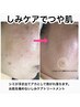 40代50代人気施術1位【シミケアデトックス】新陳代謝を上げ明るいお肌へ