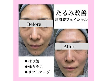 ベアトリーチェ 五反田(Beatrice)の写真
