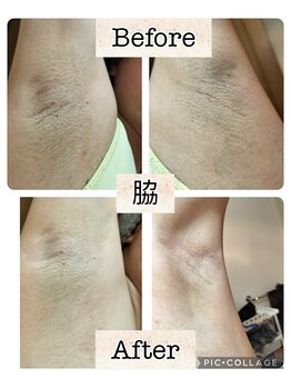 エピス(Epice)/ローマピンク(脇)