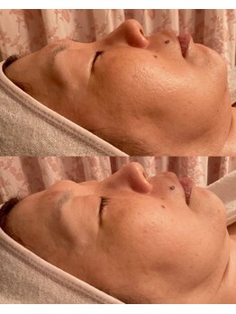 ポーラ Vell Marry店(POLA)/透明感UP!!