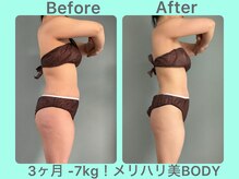 ビーナイス ビューティー(Be Nice Beauty)/月2回施術☆ FASTING なし！