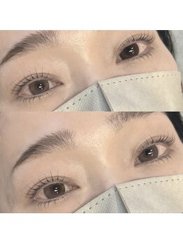 リグ(LIG)/上下まつぱ