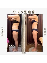 ビーシェイプ 君津(B-Shape)/【痩身】ビフォーアフター