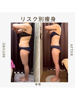 ビーシェイプ 君津(B-Shape)/【痩身】ビフォーアフター