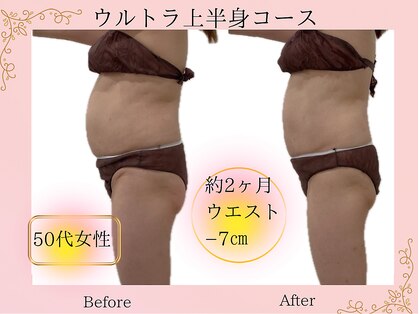 フルーア(FULUA)の写真