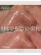 ココ 千里丘(Cocoh)の写真/夏の強い紫外線に美白ケアで挑む!一回でもこの変化を体感し透明感あふれる肌へ♪
