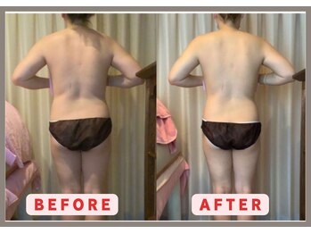 RHB東戸塚/痩身エステはRHB東戸塚