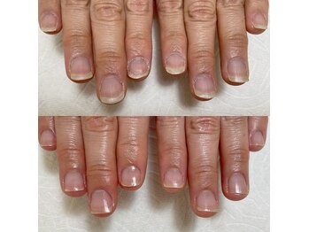 エマネイル(emma nail)/褒められる手元に！