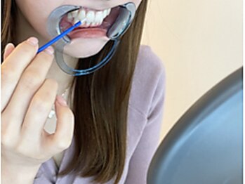 エクシアホワイトニング 江坂店/5．歯に溶剤(ジェル)を塗る