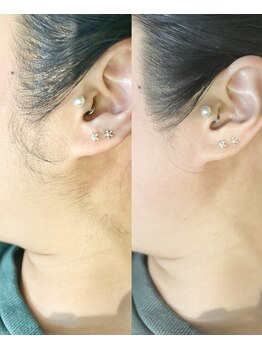 十美/【もみあげWAX♪】before after