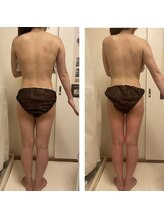 ヨサパーク サンク 日吉(Yosa Park Thank)/通うことで結果出ます