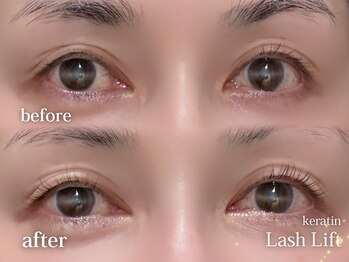 ディッチャ(Dicha)/◇ラッシュリフト◇