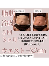 アイビー(IVY)/モニター様