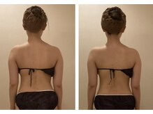 小顔コルギ専門店 フェルーシュ 成田駅前店(Feruche)/背中+小顔コルギ　1回目結果