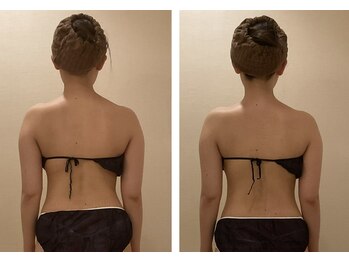 小顔コルギ専門店 フェルーシュ 成田駅前店(Feruche)/背中+小顔コルギ　1回目結果