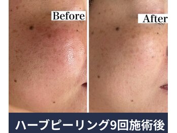 エルア 尼崎(Elua)/