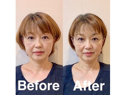 セラピーインカローズの写真