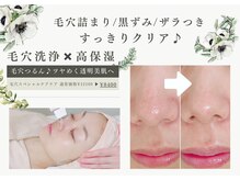 フェイシャルエステ エムズルーム(M's room)の雰囲気(毛穴詰り/黒ずみ/ザラつきをすっきり洗浄♪ツヤめく透明美肌へ!)