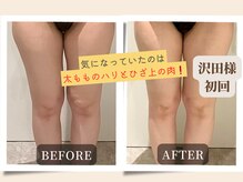 ビューティーサロンエー 心斎橋店(Beauty Salon A)/下半身でも太腿が気になって！！