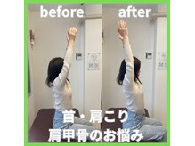 とるこり美姿整体院 新宿院の雰囲気（《猫背・巻き肩/肩こりでお悩みのご新規様》1回目の施術効果！）