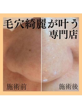 ククナ(kukuna)/毛穴ケア