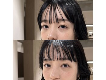イェニ(YENI)/before / after