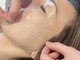 ラルミエール 緑店はなれ(la lumiere)の写真/【新世代リフトアップ】コラーゲンでリフトアップ&レモンボトルで脂肪分解◎たるみ、ホウレイ線を徹底改善!