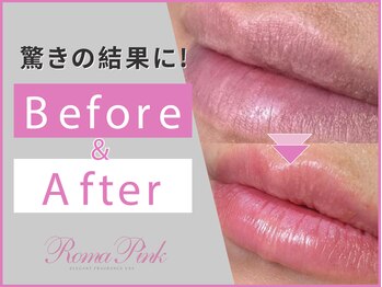 ルル(ruru)/ローマピンク