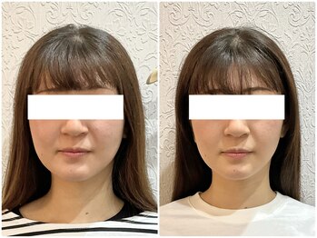 美容整体ウェリナ あま甚目寺院/小顔矯正/骨盤矯正/美脚サロン