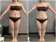 美容整体 ウェリナ 蟹江院/小顔矯正/骨盤矯正/美脚サロン