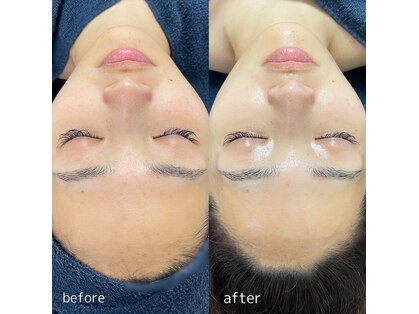 オーガスター(ORGASTAR)の写真