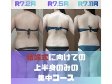 宮崎市でキャビテーションが人気のエステサロン｜ホットペッパー 