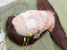 【包潤フェイスパック美容鍼】￥12,000 ＊電気はオプションになります