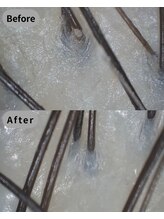 ストリクス(STRIX)/Before/After 【ヘッドスパ】