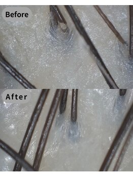 ストリクス(STRIX)/Before/After 【ヘッドスパ】