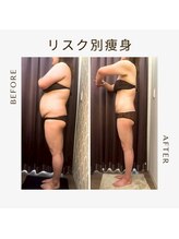 ビーシェイプ 君津(B-Shape)/【痩身】ビフォーアフター