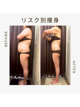 ビーシェイプ 君津(B-Shape)/【痩身】ビフォーアフター