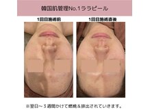 ミーカラー(mecalla.)/ララピールBA