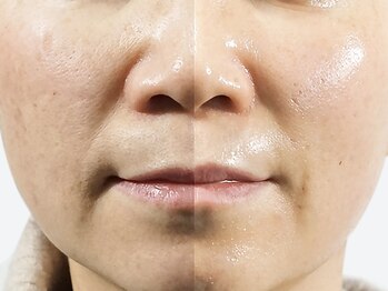 クリアー(CLEAR.)/【Before＆After】