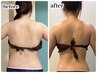【本気の痩身サイズダウン】気になる所を徹底的に引き締めインディバ60分3回