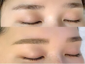 ココミュウ(Coco Mieux)/Before→After