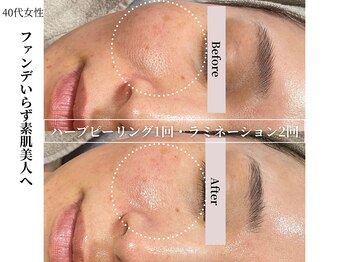 ヴィタベラ(Vita Bella)/ハーブ+ラミネーション