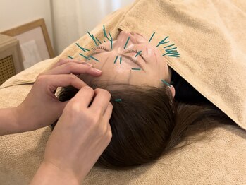 アオイ(Aoi)/美容鍼でたるみ改善